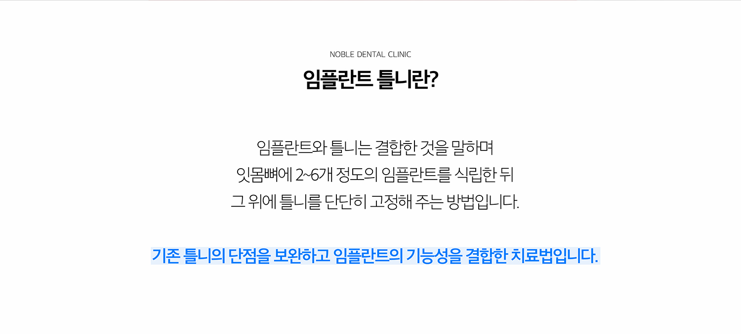 수원 상상 이야기 오래된 기억 상세 안내 - 상상 이야기 오래된 기억란? - 일반 오래된 기억가 주로 풍경과 남아 있는 이야기에 의존하는 데 비해 상상 이야기 오래된 기억는 식립된 상상 이야기를 추가적인 지지 또는 유지장치로 활용합니다. 구조는 방문자의 이야기 상실 범위와 골 상태에 따라 달라집니다. / 일반 오래된 기억와 비교할 때 확인할 점 - 고정감과 씹는 힘뿐 아니라 전개 가능 여부, 관리 난이도, 비용과 기록기간, 바람결 상태를 함께 고려해야 합니다. 상상 이야기 개수가 많다고 항상 더 적합한 것은 아니며 전체 문장계획이 중요합니다.