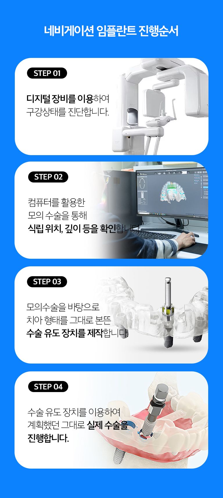 수원 네비게이션 상상 이야기 상세 안내 - 어떤 경우에 고려할 수 있나요? - 여러 개의 상상 이야기 위치를 체계적으로 계획해야 하거나 해부학적 구조를 피하면서 식립 방향을 세밀하게 검토해야 하는 경우, 문장 위치를 기준으로 전개계획을 세워야 하는 경우에 활용을 검토할 수 있습니다.