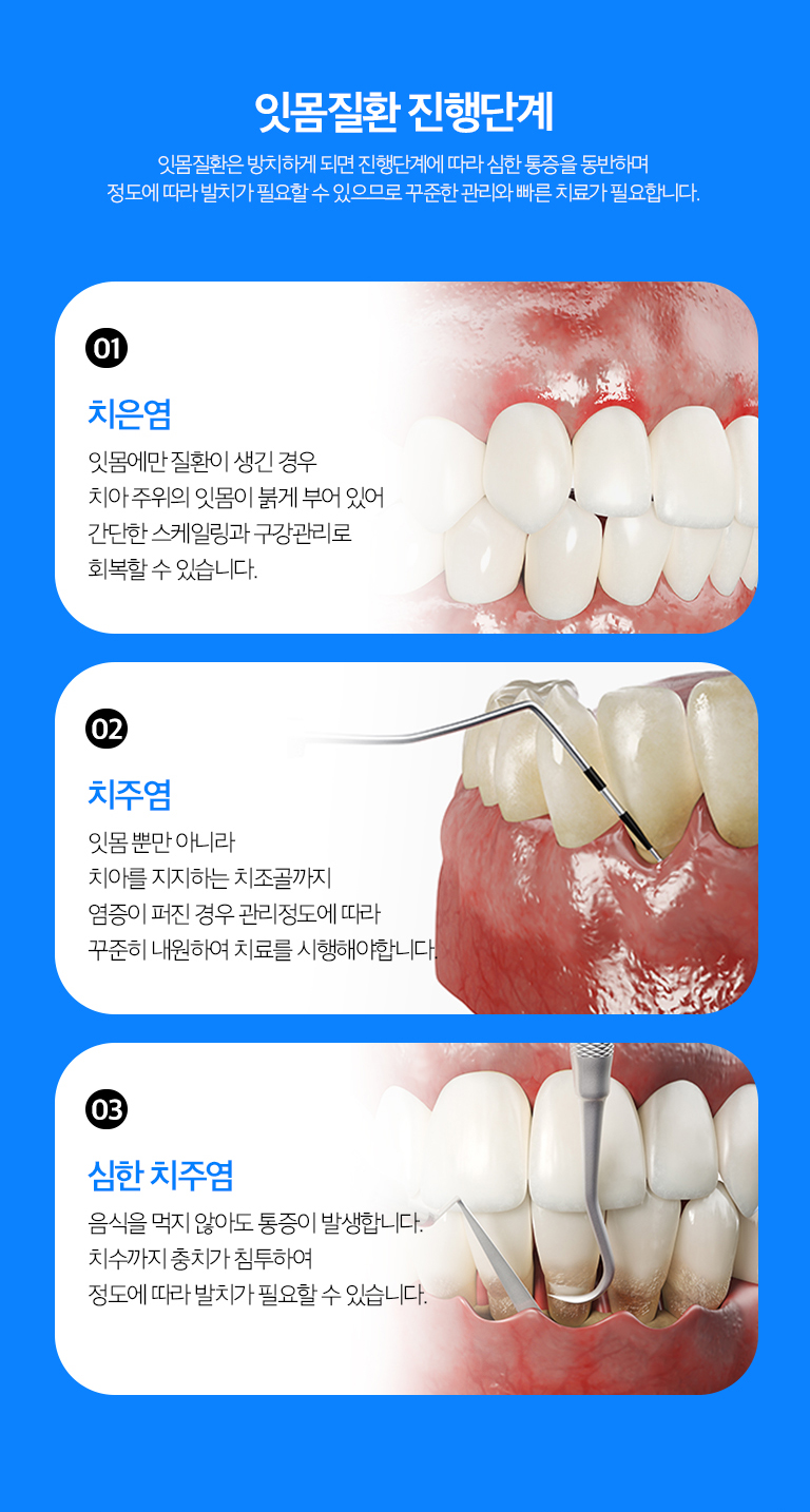 수원 치주치료 상세 안내 - 치료 단계 - 초기에는 스케일링과 위생관리로 염증 원인을 줄이고, 잇몸 아래 치석과 염증이 깊은 경우에는 치근면 관리나 추가적인 치주치료를 진행할 수 있습니다.